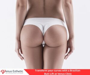 Plastic Surgery, Rhinoplasty, Brazilian butt lift, botox, nose job istanbul, rhinoplasty istanbul, nose surgery istanbul, rhinoplasty turkey istanbul, best doctro in turkey, venus rihnoplasty, venus clinic turkey, best rhinoplasty doctor in turkey, best rhinoplasty doctor in usa, best rhinoplasty doctor in uk, venus esthetic clinic, vera clinic, turkeyana clinic, olcay saygin, dr zen hair, dr cinik, venus clinic turkey, Brazilian butt lift usa, Brazilian butt lift uk, Brazilian butt lift turkey, Brazilian Butt Lift