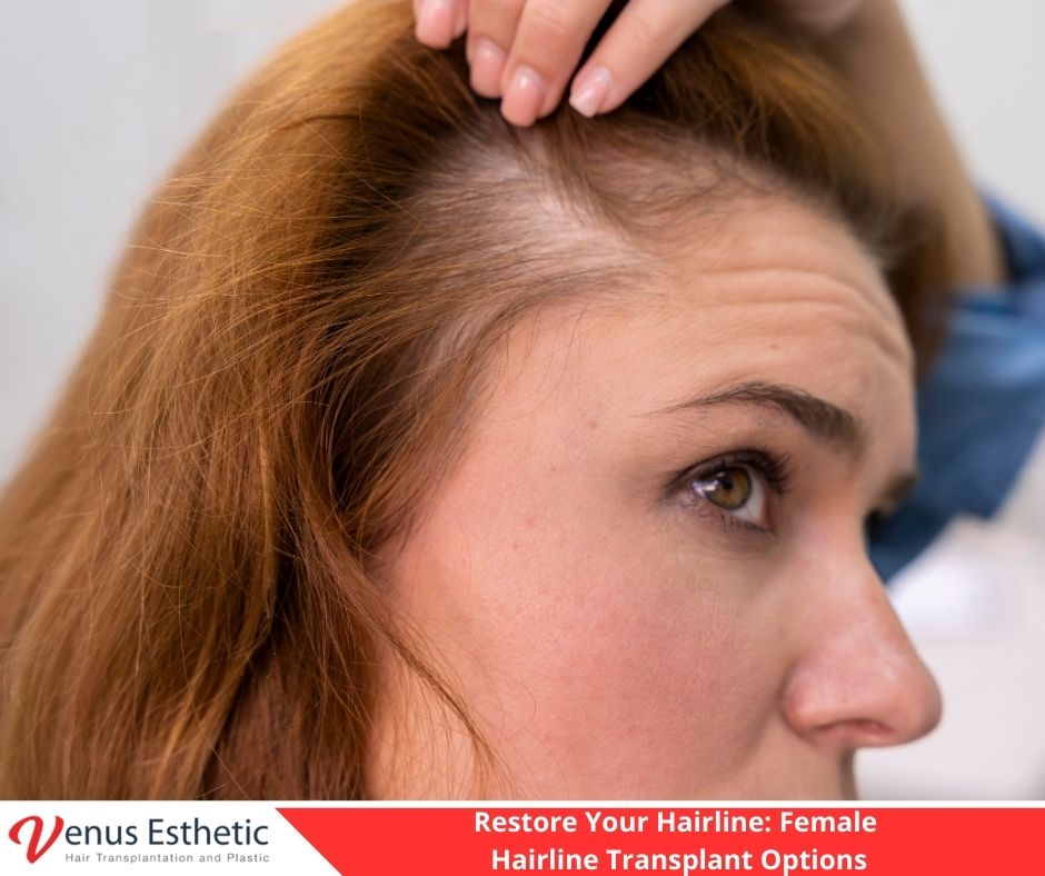 Female Hairline Transplant, hair transplant, hair transplant in turkey, best hair transplant clinic in Turkey, best hair transplant doctor in turkey, hair transplant cost, Eyebrow Transplant