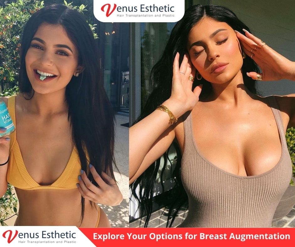Explore Your Options for Breast Augmentation