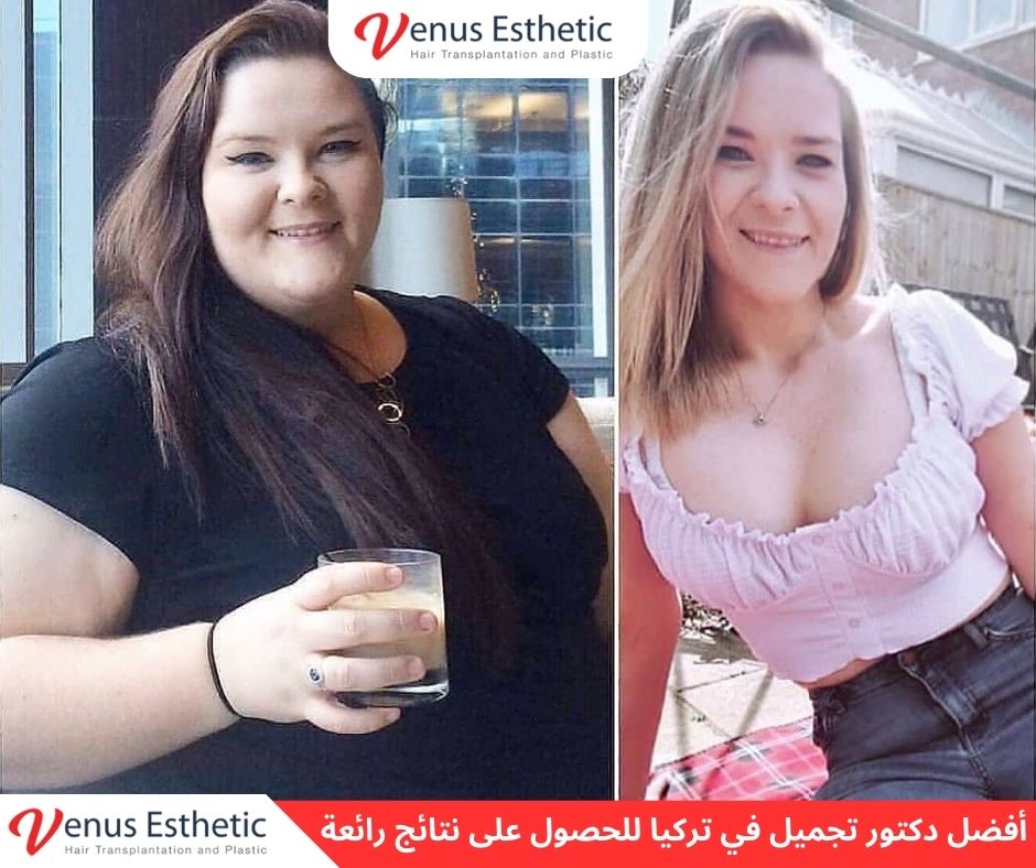 ,أفضل دكتور نحت الجسم في تركيا, أفضل دكتور تجميل أنف في تركيا, أفضل دكتور زراعة شعر في تركيا, دكتور تجميل عربي في اسطنبول, أفضل دكتور تجميل في تركيا